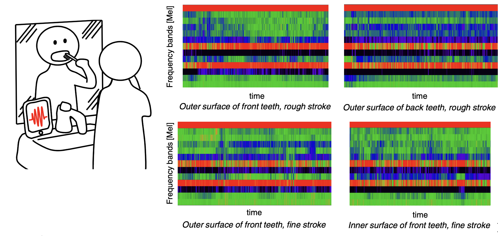 Figure for Evaluating Tooth Brushing Performance With Smartphone Sound Data